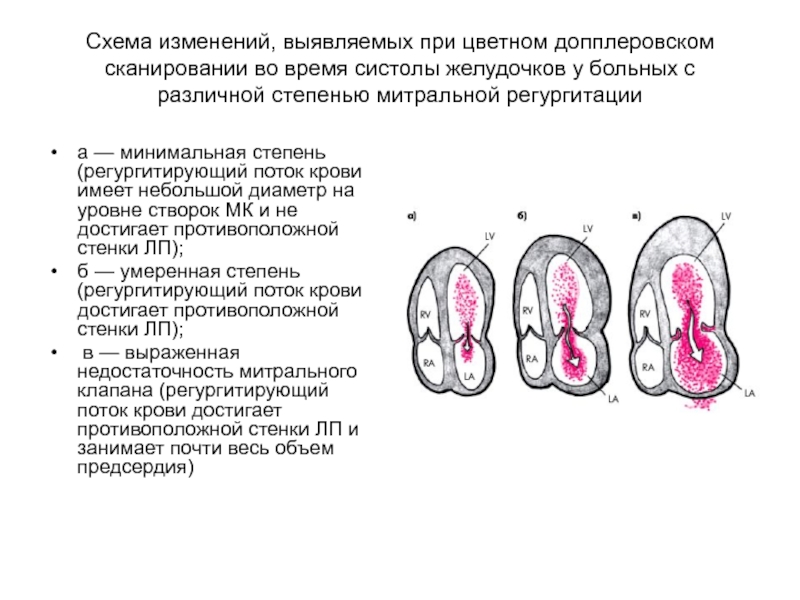 Хирургическое лечение пороков сердца презентация