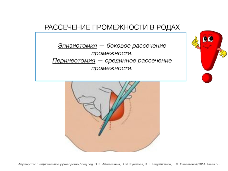 Эпизиотомия. Эпизиотомия и перинеотомия. Срединно латеральная эпизиотомия. Эпизиотомия и перинеотомия показания.