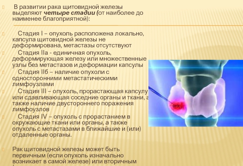 Злокачественные опухоли щитовидной железы презентация