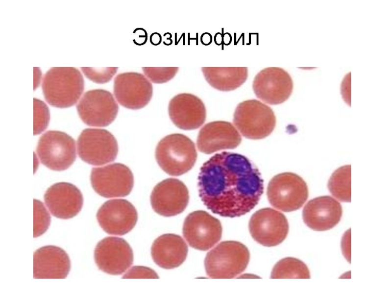 Ядро эозинофила. Эозинофилы гистология. Эозинофилия гистология. Эозинофилы на препарате крови. Эозинофилы в крови рисунок.