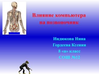 Влияние компьютера на позвоночник