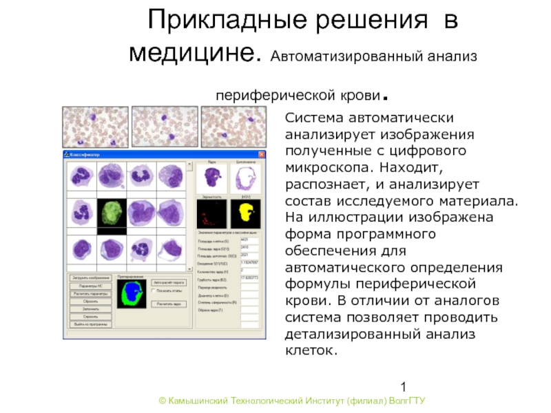 Прикладные решения. Методы автоматизированного исследования клеток крови. Автоматизированный анализ. Анализ автоматизированных клеток крови. Анализ перефериче периферический отпечаток.