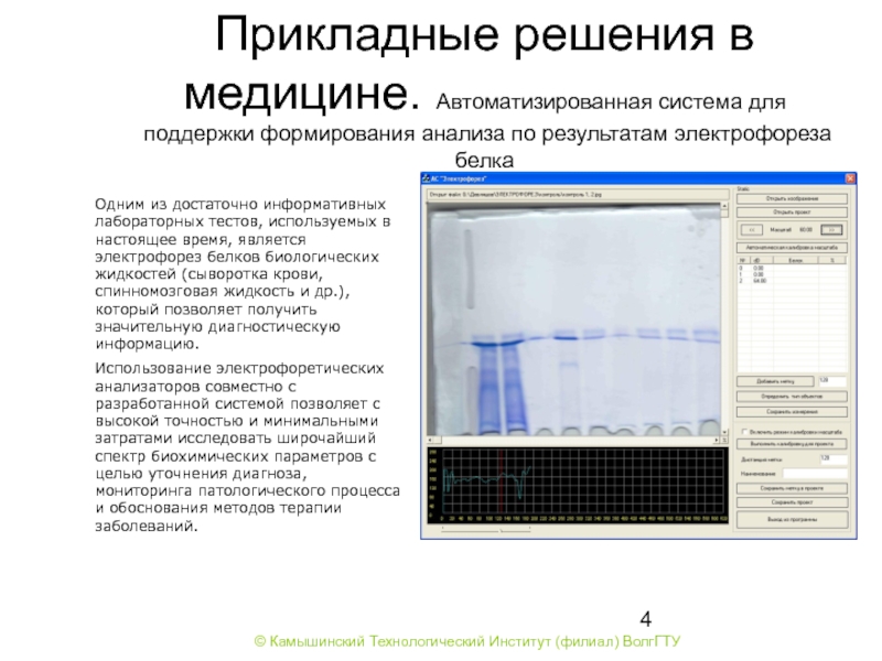 Электрофорез по разбитым зеркалом. Электрофорез белков в медицине. Метод электрофореза в медицине. Электрофорез ,tkrjd d VTLBW yt. Электрофорез белков проводят на.