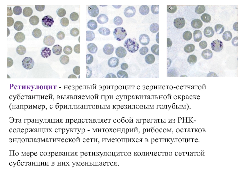 Повышенные ретикулоциты