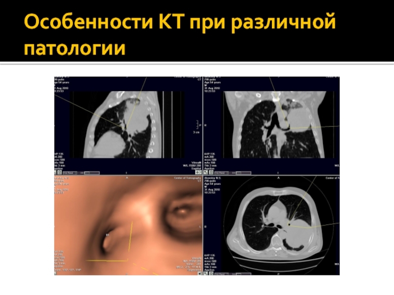 Различные патологии. Компьютерная томография характеристика. Кт особенности методики. Визуализация при кт. Окно визуализации кт.