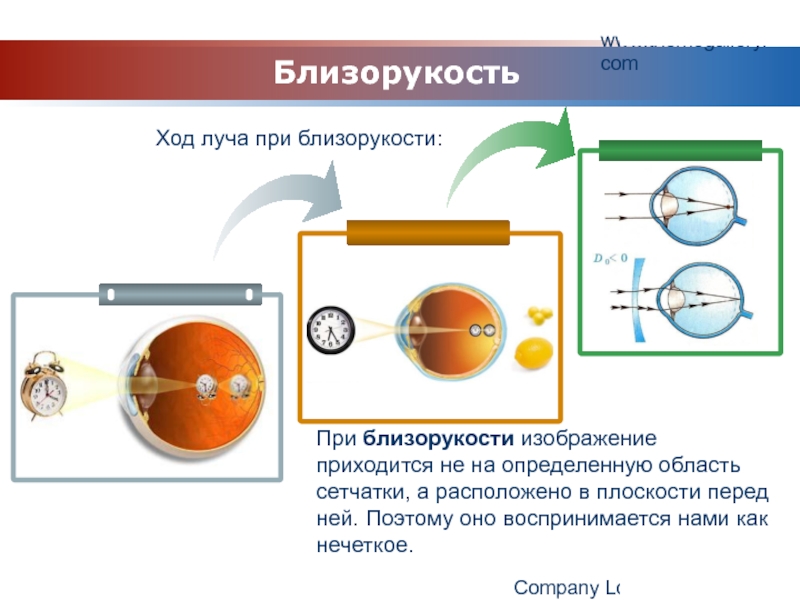 Презентация на тему близорукость и дальнозоркость физика презентация