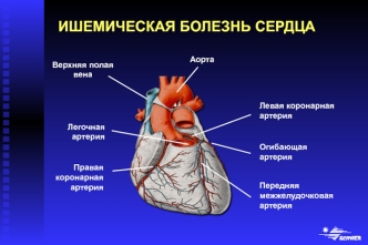 Ишемическая болезнь сердца