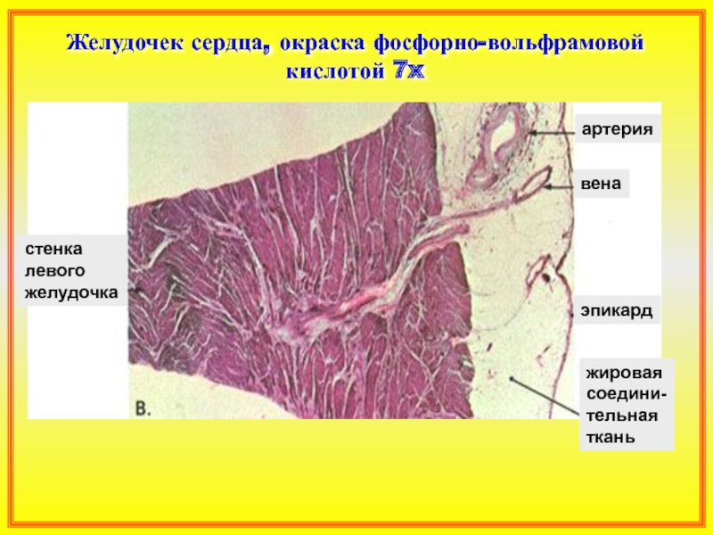 Стенки правого желудочка толще стенок левого. Стенка желудочка сердца гистология. Строение сердца гистология. Стенки левого желудочка сердца. Стенка сердца препарат гистология.
