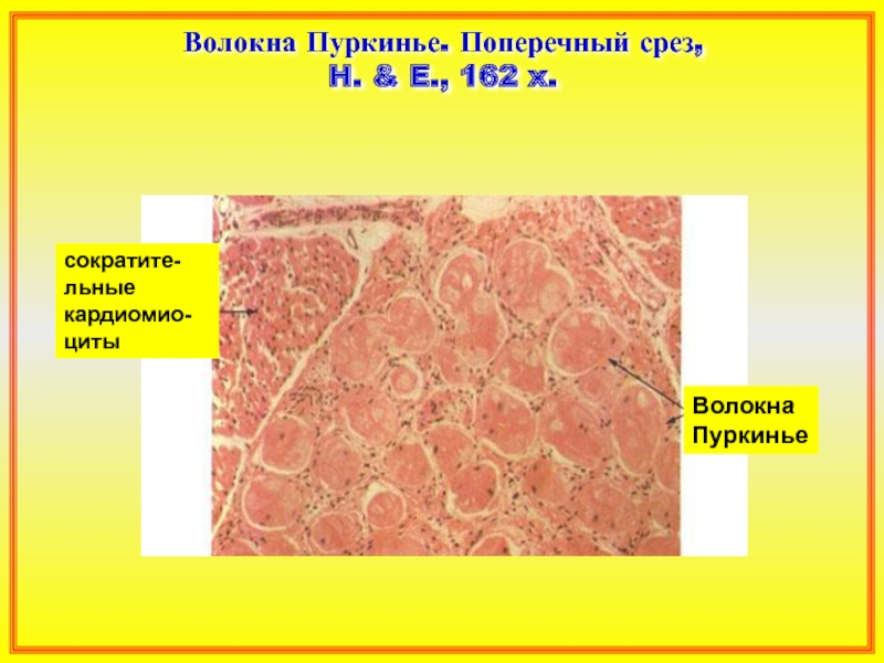 Волокна пуркинье гистология рисунок
