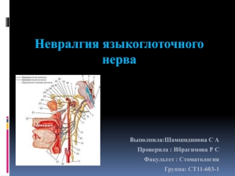 Невралгия языкоглоточного нерва