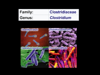 Clostridium perfringens