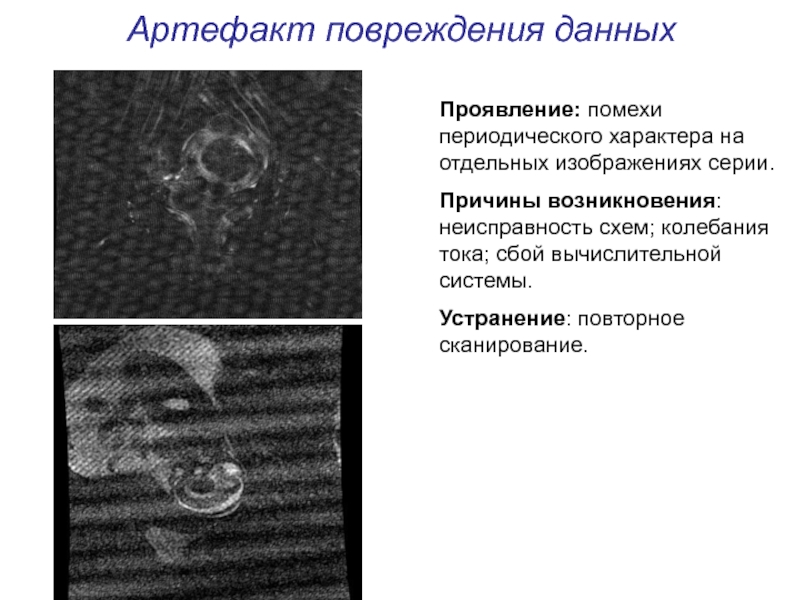 Артефакты мрт презентация