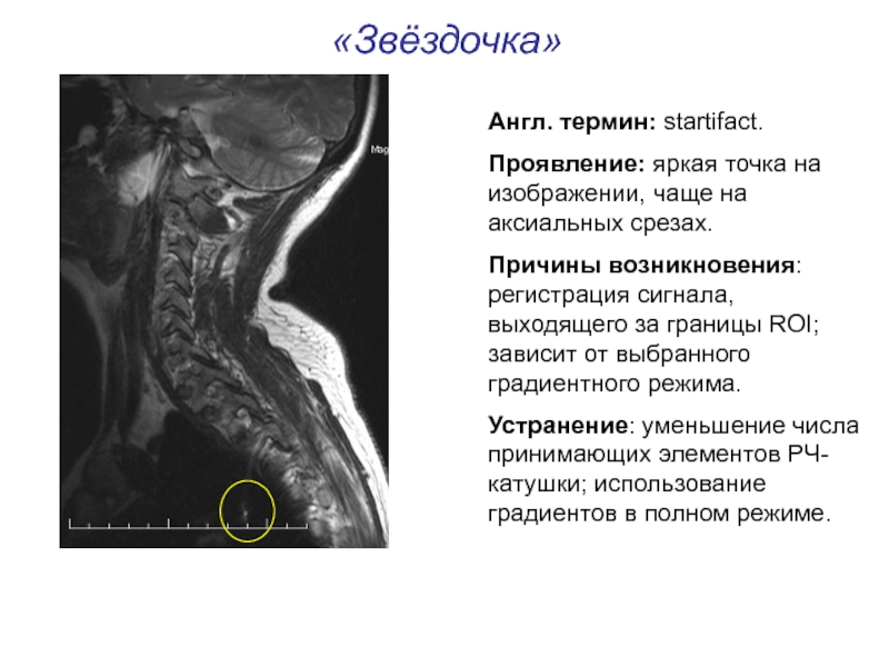 Артефакты мрт презентация