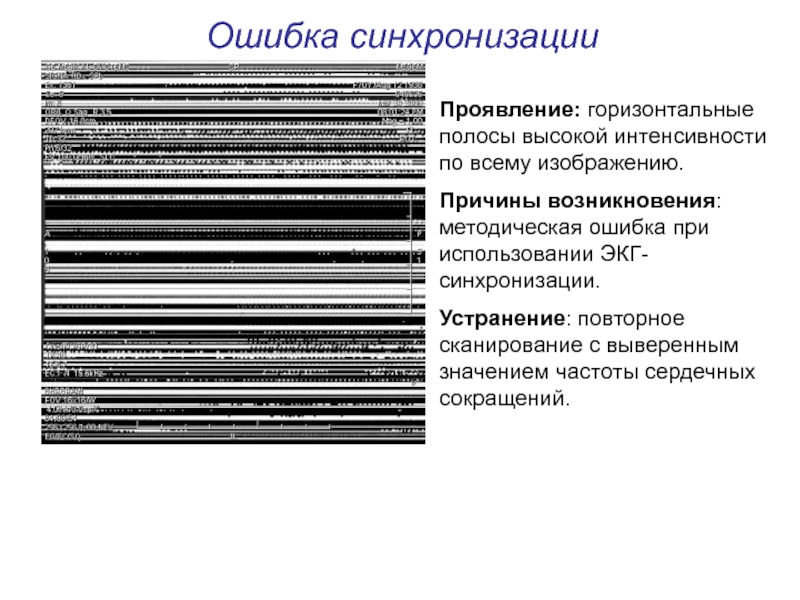 Артефакты мрт презентация