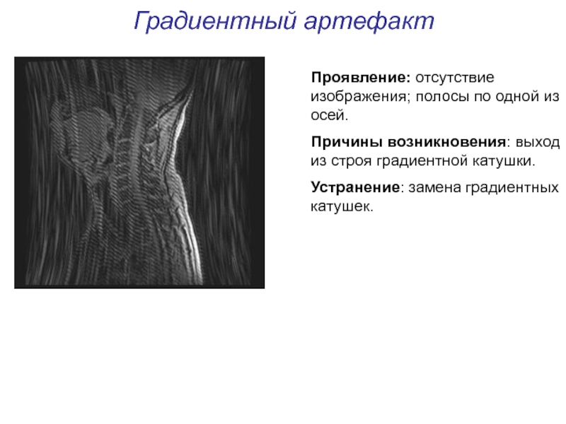 Артефакты мрт презентация