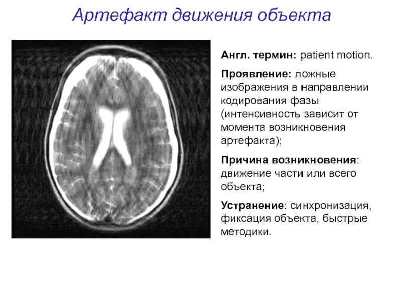 Артефакты в проекте это