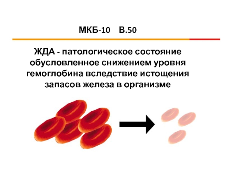 Мкб анемия средней степени. Железодефицитная анемия мкб 10. Патологические состояния гемоглобина. Жда мкб. Гипохромная анемия.