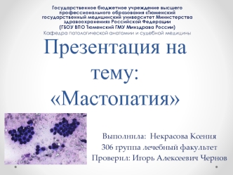 Мастопатия. Эпидемиология, этиология, классификация, патогенез, клиническая картина