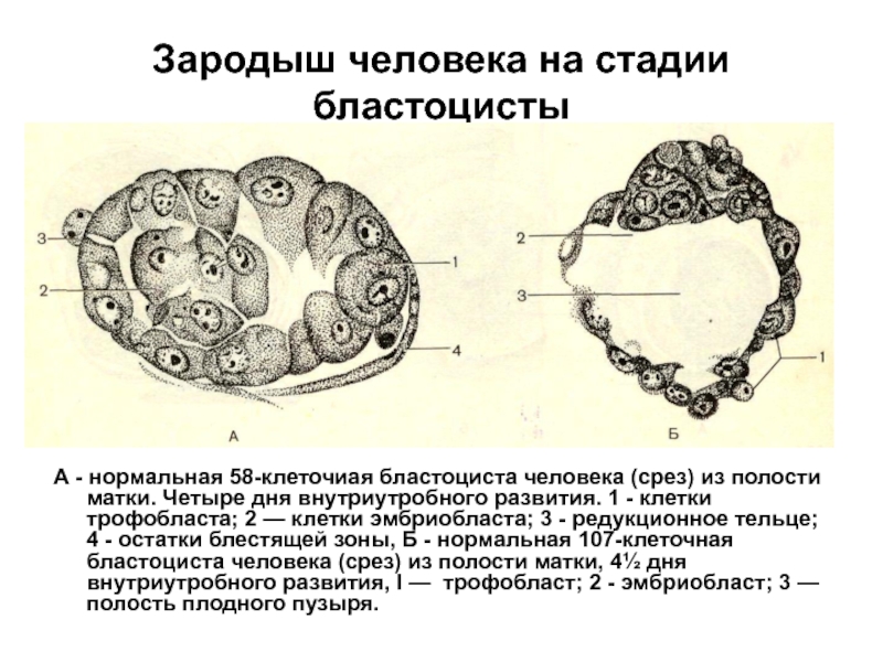 Бластоциста у ребенка