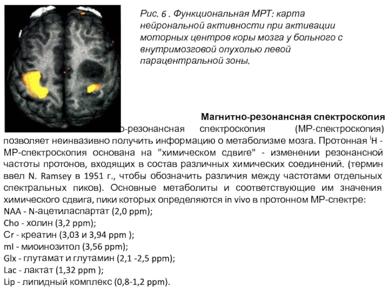 Функциональная мрт презентация