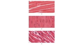 The mechanism of cardiac automaticity