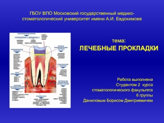 Лечебные прокладки