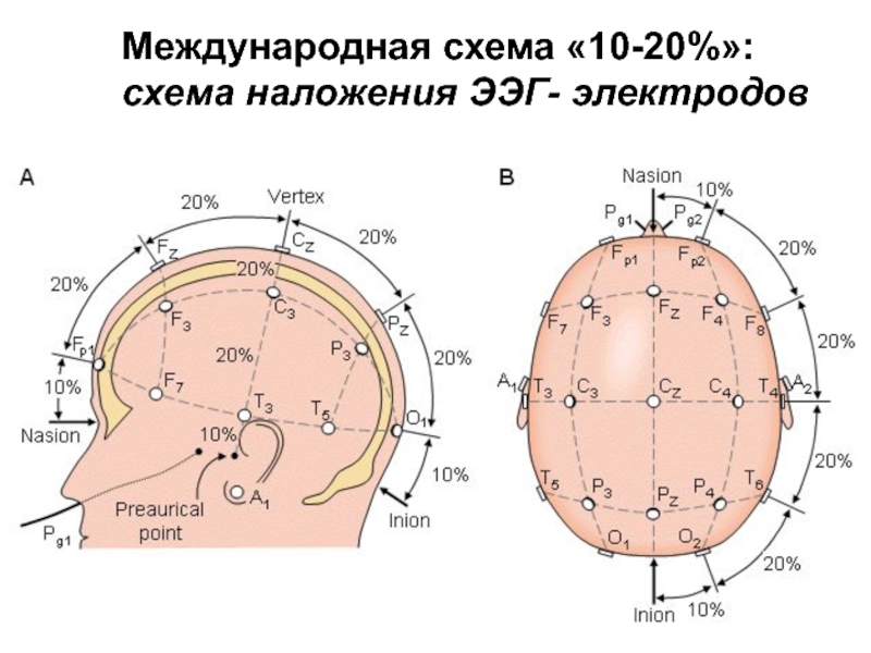 Правильное наложение электродов монитора