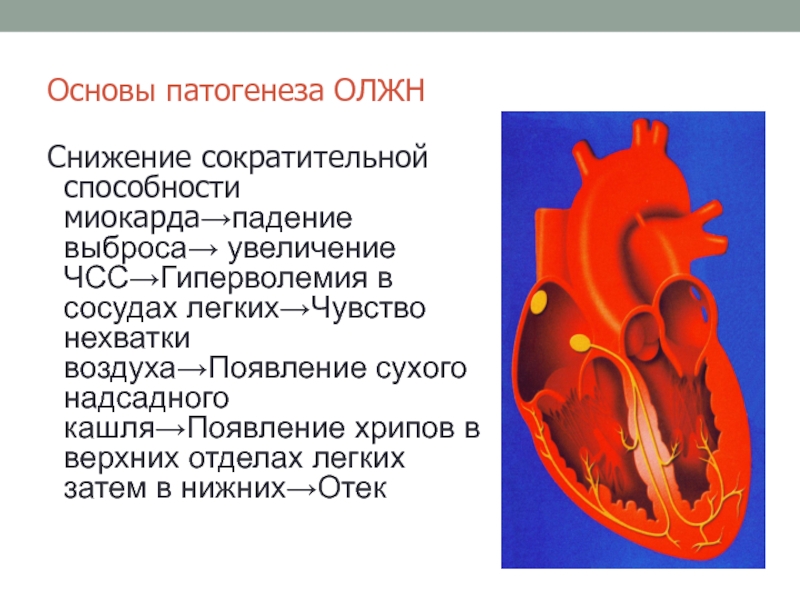 Осложнения инфаркта миокарда 