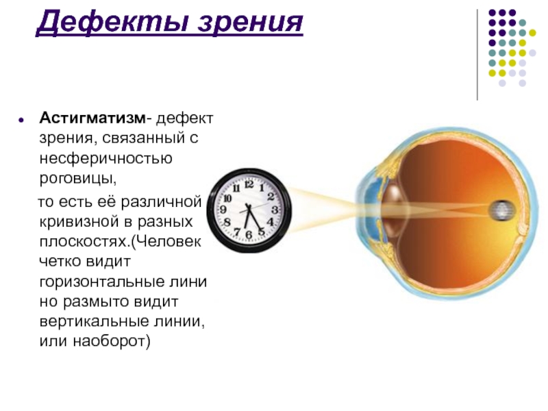 Рисунок дефекты зрения