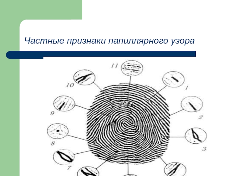 Назовите структурные зоны и элементы строения папиллярного рисунка ногтевой фаланги пальца руки