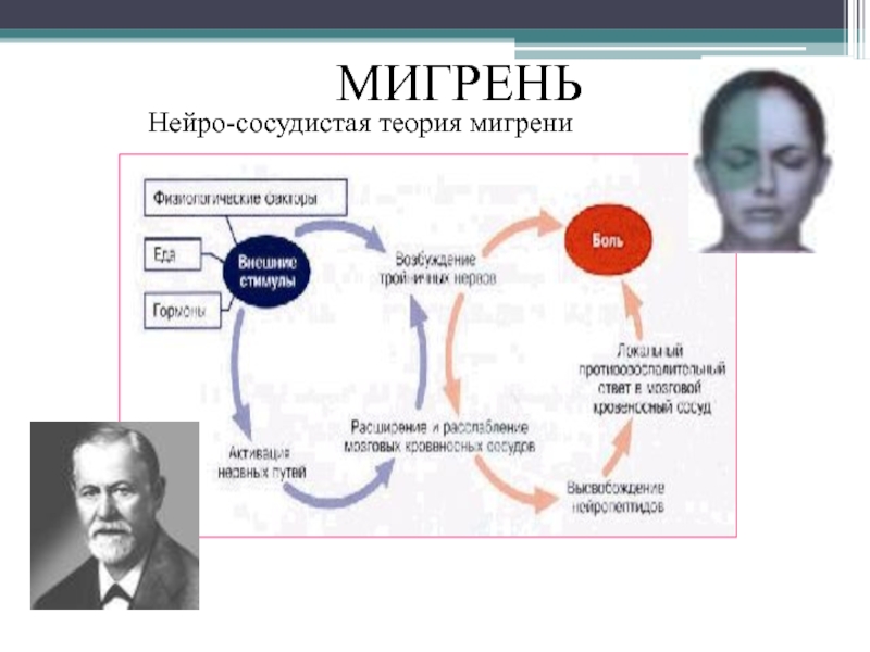 Мигрень презентация неврология