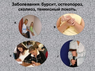 Заболевания: бурсит, остеопороз, сколиоз, теннисный локоть.