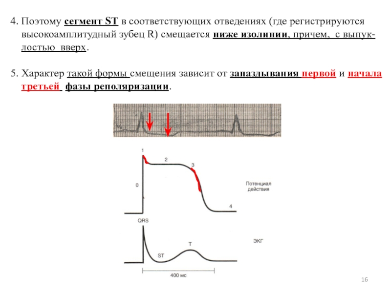 St на изолинии