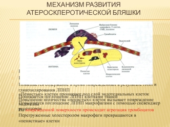 Механизм развития атеросклеротической бляшки