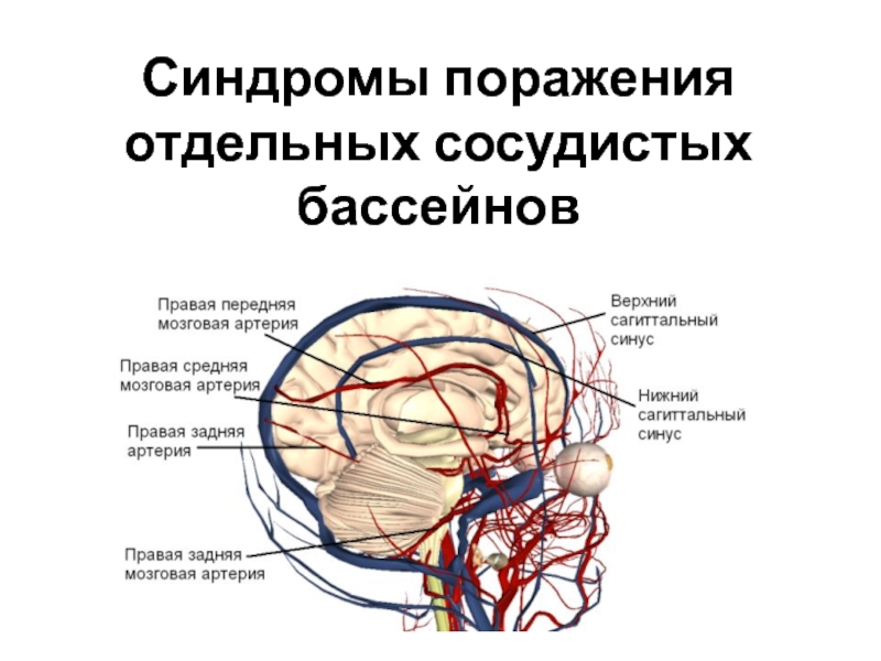 Инсульт в бассейне мозговой артерии. Кровоснабжение головного мозга каротидный бассейн. Ишемический инсульт височной доли клиника. Вертебробазилярный бассейн головного мозга ишемический инсульт. Синдромы поражения отдельных бассейнов головного мозга.