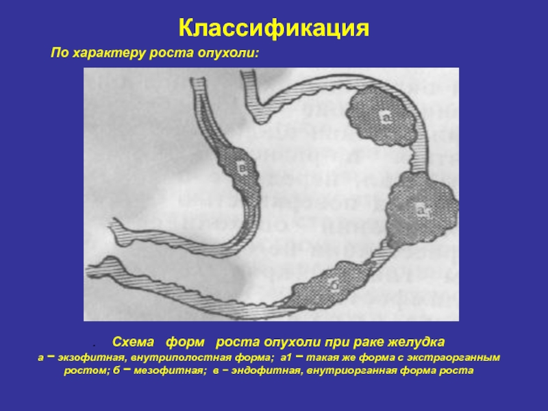 Экспансивный рост рисунок