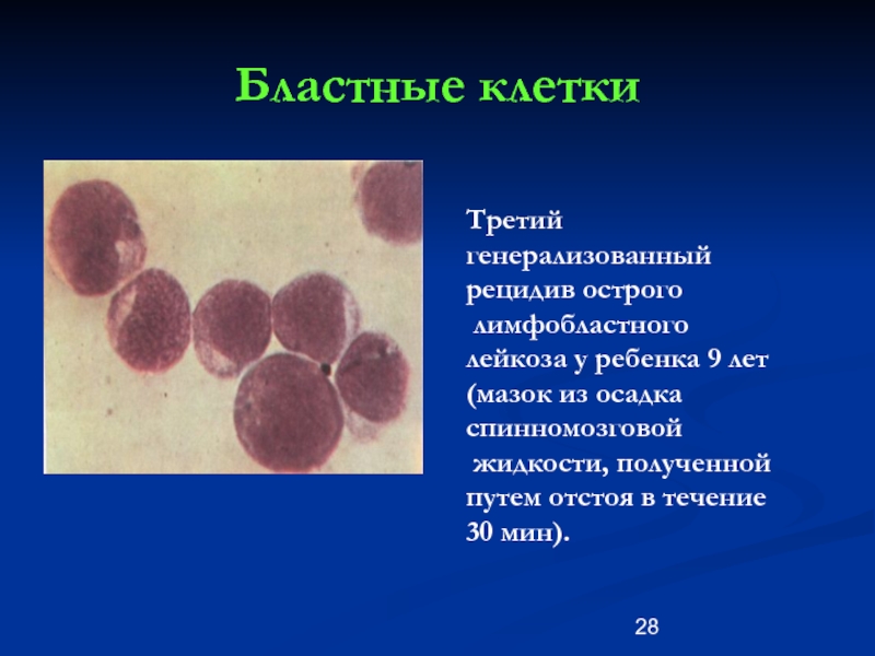 Рецидив острого лейкоза. Бластные клетки в ликворе. Бластные клетки норма у детей. Бластные клетки в крови у ребенка.