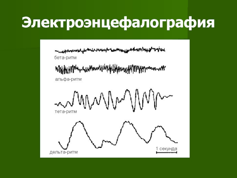 Альф ритм. Альфа и тета ритмы ЭЭГ. ЭЭГ Альфа бета. Альфа ритм бета ритм. Амплитуда ритмов Альфа бета.