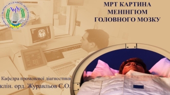 Менінгіоми головного мозку. МРТ