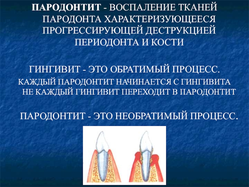 Ортопедические методы лечения генерализованного пародонтита презентация