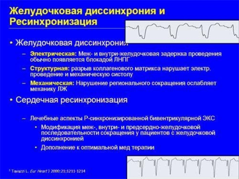 Ресинхронизирующая терапия презентация