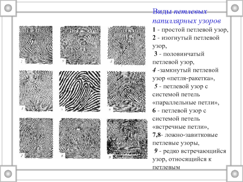 Типы папиллярных узоров. Виды петлевых папиллярных узоров. Основные типы папиллярных узоров криминалистика. Петлевой папиллярный узор. Типы петлевых папиллярных узоров вид простой.