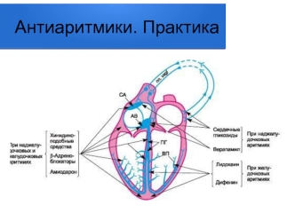 Антиаритмики. Практика