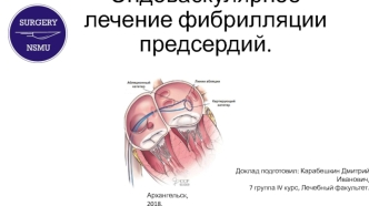 Эндоваскулярное лечение фибрилляции предсердий