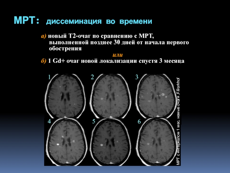 Орэм мрт картина