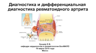 Диагностика и дифференциальная диагностика ревматоидного артрита