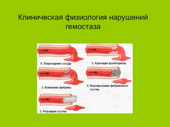 Клиническая физиология нарушений гемостаза