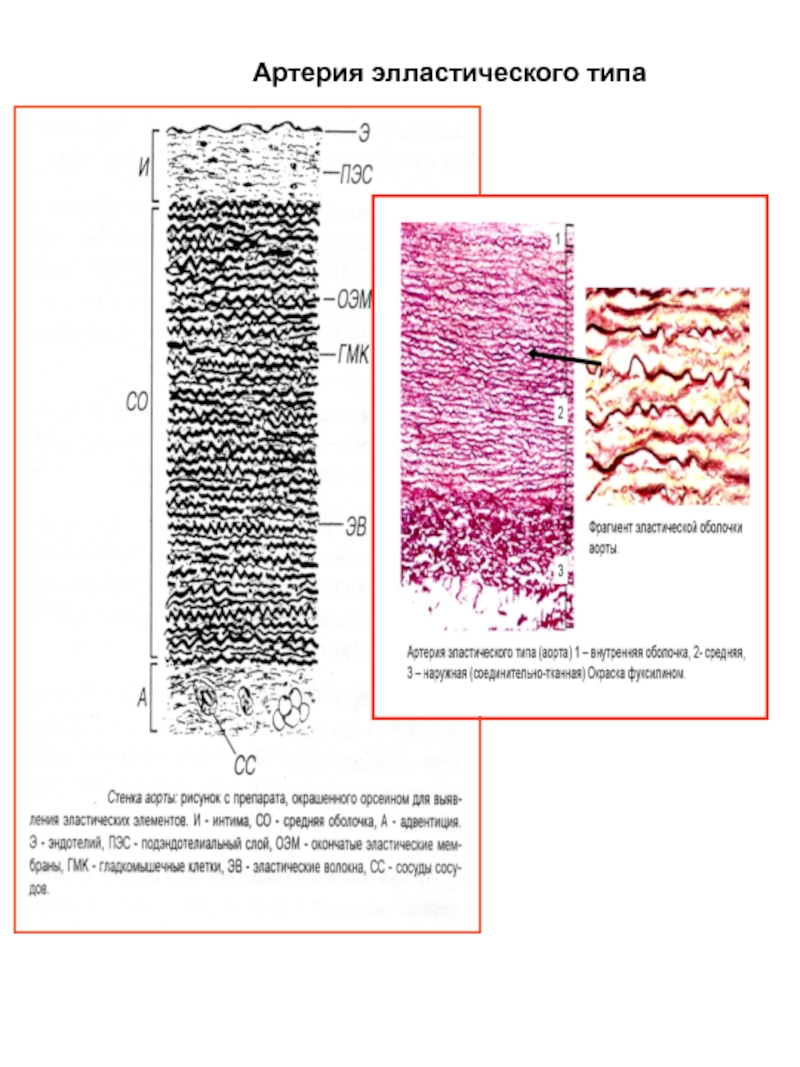 Артерии эластического типа гистология рисунок