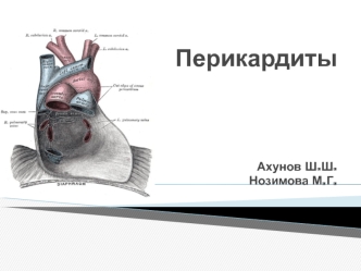 Перикардиты. Этиологическая классификация