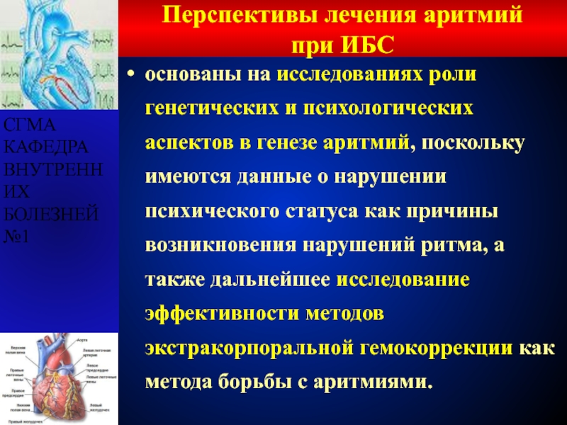 Аритмия лечение. Перечислите причины возникновения аритмий:. ИБС нарушения сердечного ритма. ИБС нарушение ритма сердца. Характер аритмии.